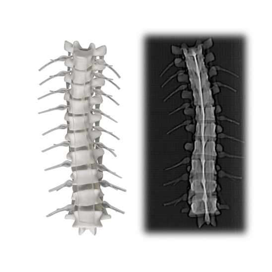 RadioMatrix comparison X-Ray image