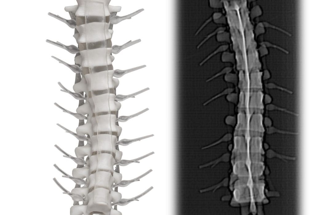 DICOM anatomy 3D printed